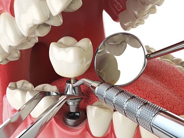 Best Weekend Emergency Dentist in Baker City, OR